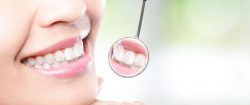 Best Cosmetic Dentist In Houston, TX