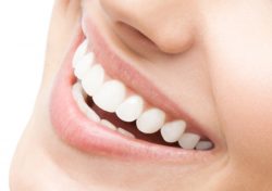 Professional Teeth Whitening Near Me