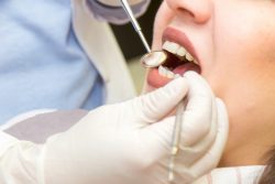 Expert Orthodontist in Miami