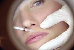 Dermal Filler Treatment