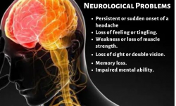 Guide To Becoming A Neurology Doctor