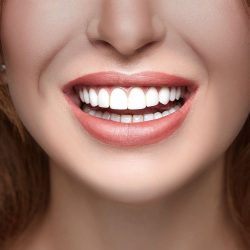 Porcelain Veneers Cost