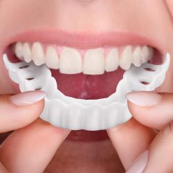 What Are Snap On Veneers?