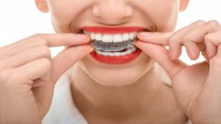 Find an Invisalign Doctor Near Me