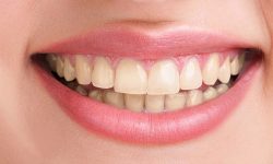 Affordable Cosmetic Dentistry Near Me