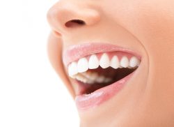 Veneers For Straight Teeth