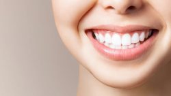 Lumineers Dental Veneers