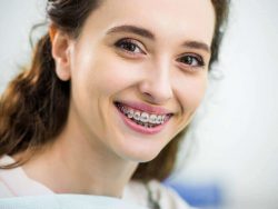 Adult Orthodontics in Miami, FL