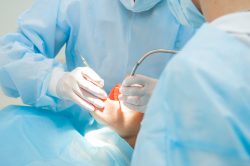 Emergency Teeth Extraction Near Me