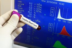 CBC Full Body Checkup in Bangalore|Get 68.6% OFF