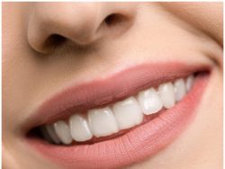 Best Teeth Whitening kit For a Brighter Smile