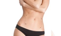 Cirugía de abdominoplastia para mujeres