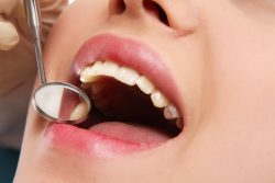 How Poor Dental Care Can Affect Your Overall Health | Walk In Dentist Houston