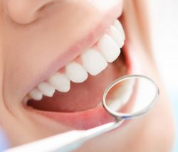 Teeth Whitening Dentist In Houston Heights