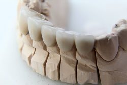 Affordable Dental Crowns Near Me