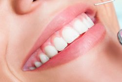 Affordable Cosmetic Dentistry Near Me