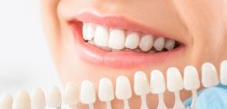 Affordable Porcelain Dental Crowns Near Me