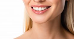 Full Mouth Dental Veneers Near Me