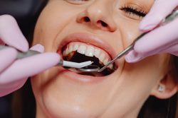 Gum Removal Surgery Near Me In Houston