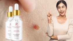 Amarose Skin Tag Remover