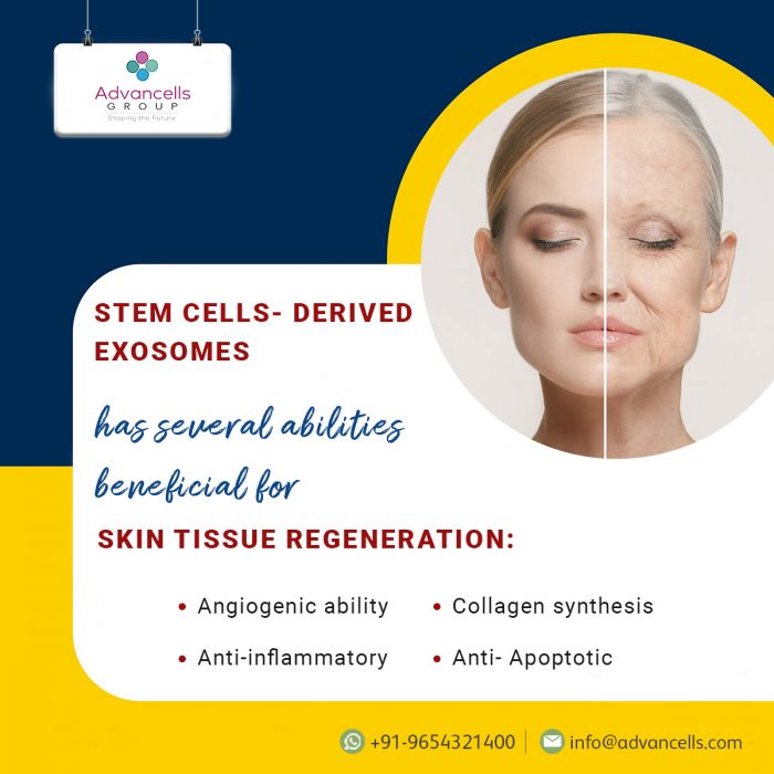 Exosomes derived from Mesenchymal Stem Cells