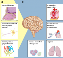 Want to become a neurology consultant?