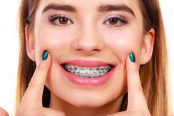 Dentist For Braces Near Me