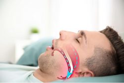 Sleep Apnea Dentists Near Me