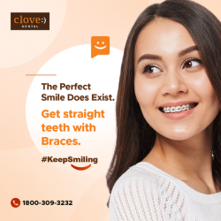 Get The Perfect Teeth Alignment Treatment at Clove Dental