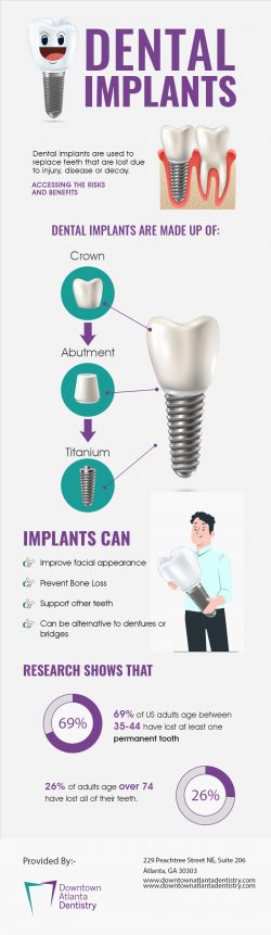 Choose Downtown Atlanta Dentistry for Implant Dentistry in Atlanta GA