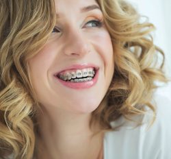 What Is Different In Adult Orthodontics?