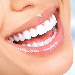 Professional Teeth Whitening Near Me In Houston, TX