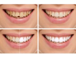 Cosmetic Dentistry Near Me