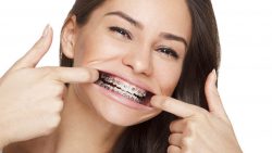 What Is Different In Adult Orthodontics?