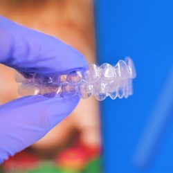 Invisalign Dentist Miami, FL – Relax and Smile Dental Care