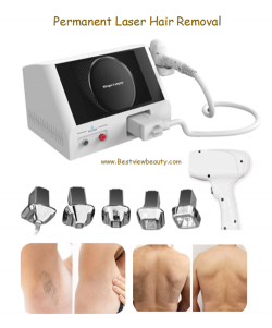 Laser hair removal