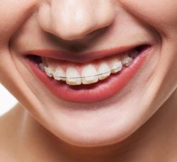 Orthodontic Specialists Of Florida