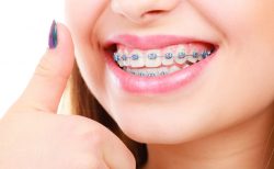 What Are The Benefits Of Orthodontics?