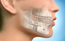 What Are The Benefits Of Orthodontics?