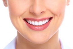 Dental Implants In Houston – Houston Dental Implants