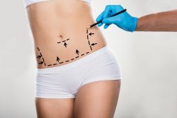 Best Laser Liposuction Surgery