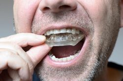 Invisalign Treatment Near Me in Miami| Miami Invisalign