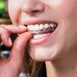 Invisalign Treatment Near Me | Find an Invisalign Doctor