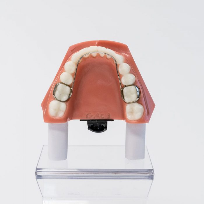 Braces Cost in Miami,FL | Braces in and near Miami, FL