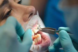 Best Orthodontist Specialists In Hialeah | Finding the Best Orthodontist