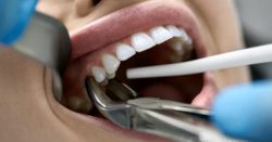 Restorative Dentistry Near Me in Houston | Restorative Dentistry Houston,