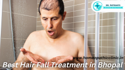 Best Hair Fall Treatment in Bhopal