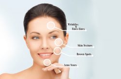 collagen stimulating treatments in California