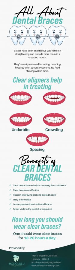 Regain Your Self Confidence With Clear Dental Braces From Honolulu Smile Design in Honolulu, HI