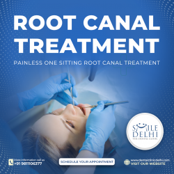 Root Canal Treatment